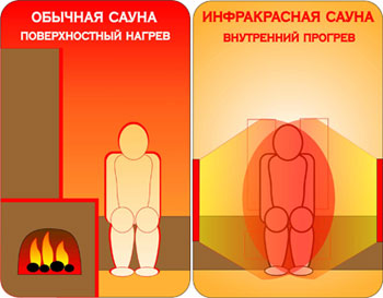 инфракрасное излучение