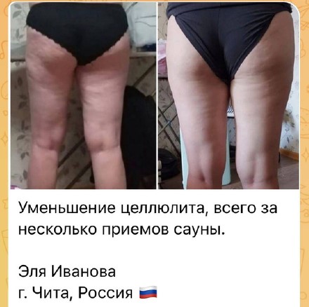 Уменьшение целлюлоза после сауны